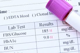 How Do We Test For Blood Sugar Dysfunction?